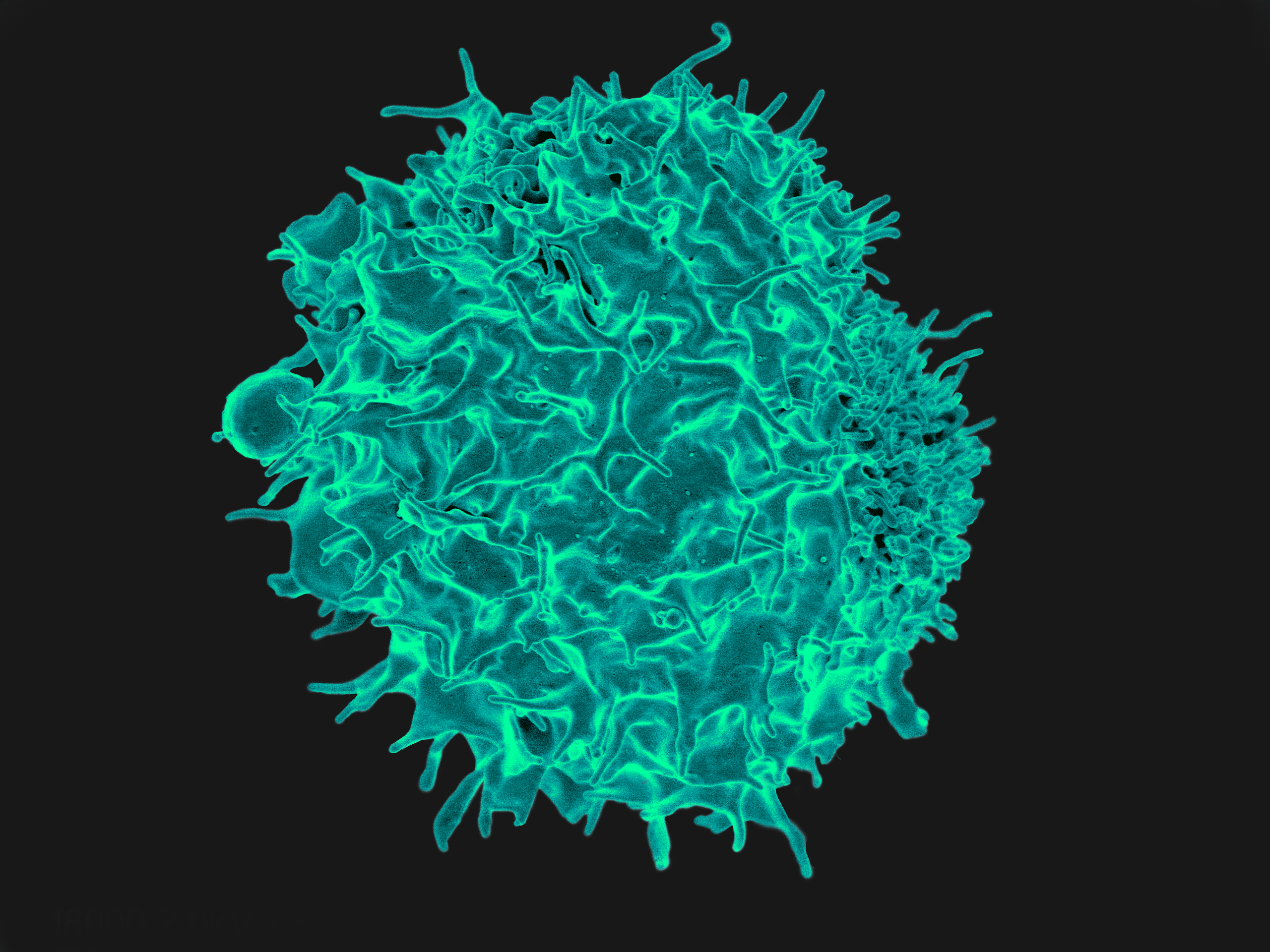 T cell - NIAID, CC BY 2.0 <https://creativecommons.org/licenses/by/2.0>, via Wikimedia Commons