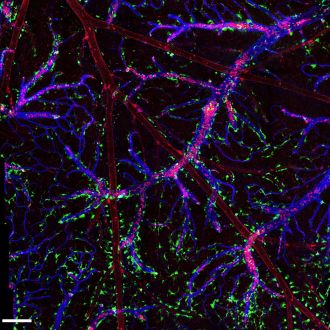  The blood vessel `highway' of the brain