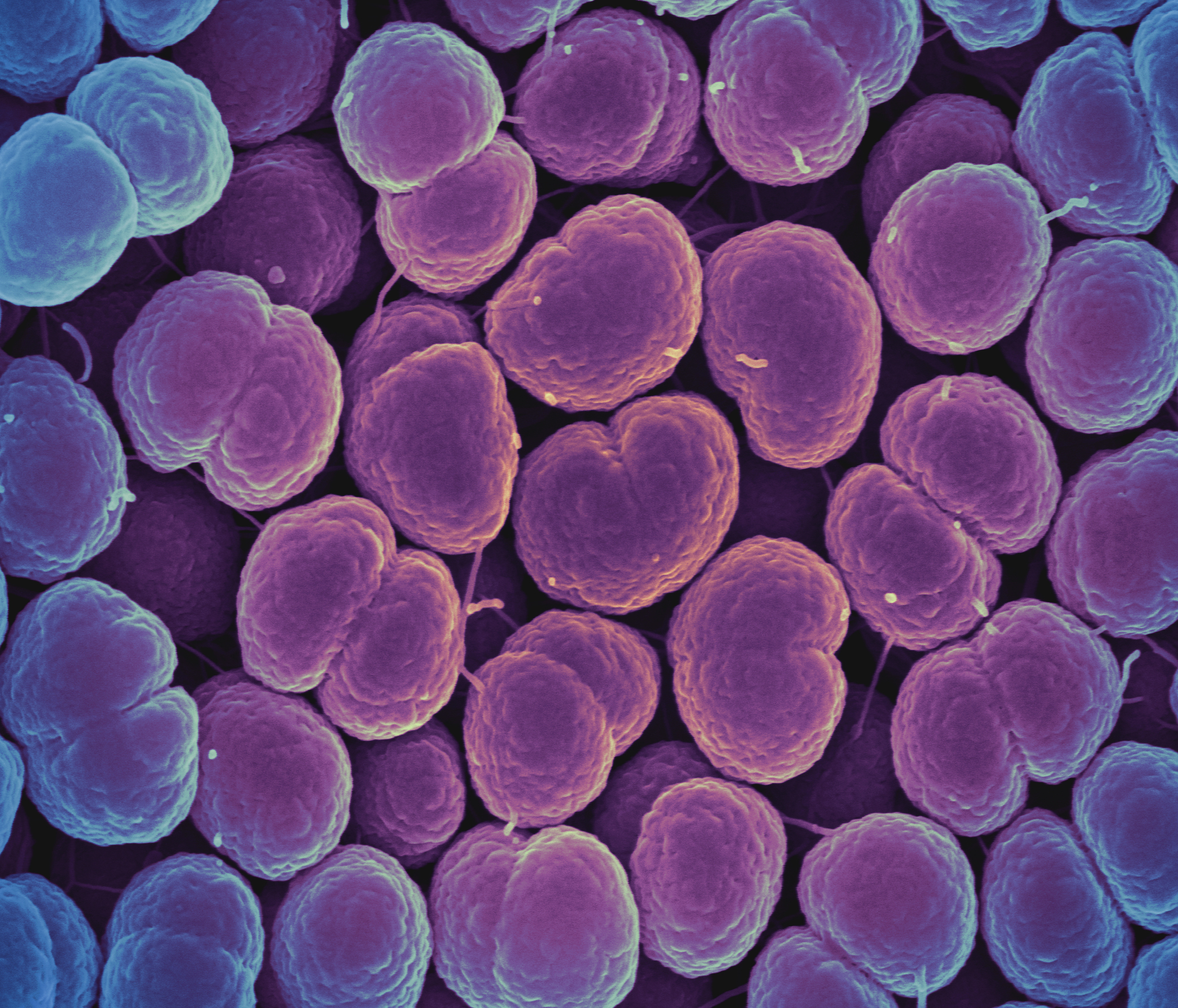 Neisseria gonorrhoeae Bacteria Colorized scanning electron micrograph of Neisseria gonorrhoeae bacteria, which causes gonorrhea. Credit: National Institute of Allergy and Infectious Diseases, National Institutes of Health, Flickr https://creativecommons.org/licenses/by-nc/2.0/