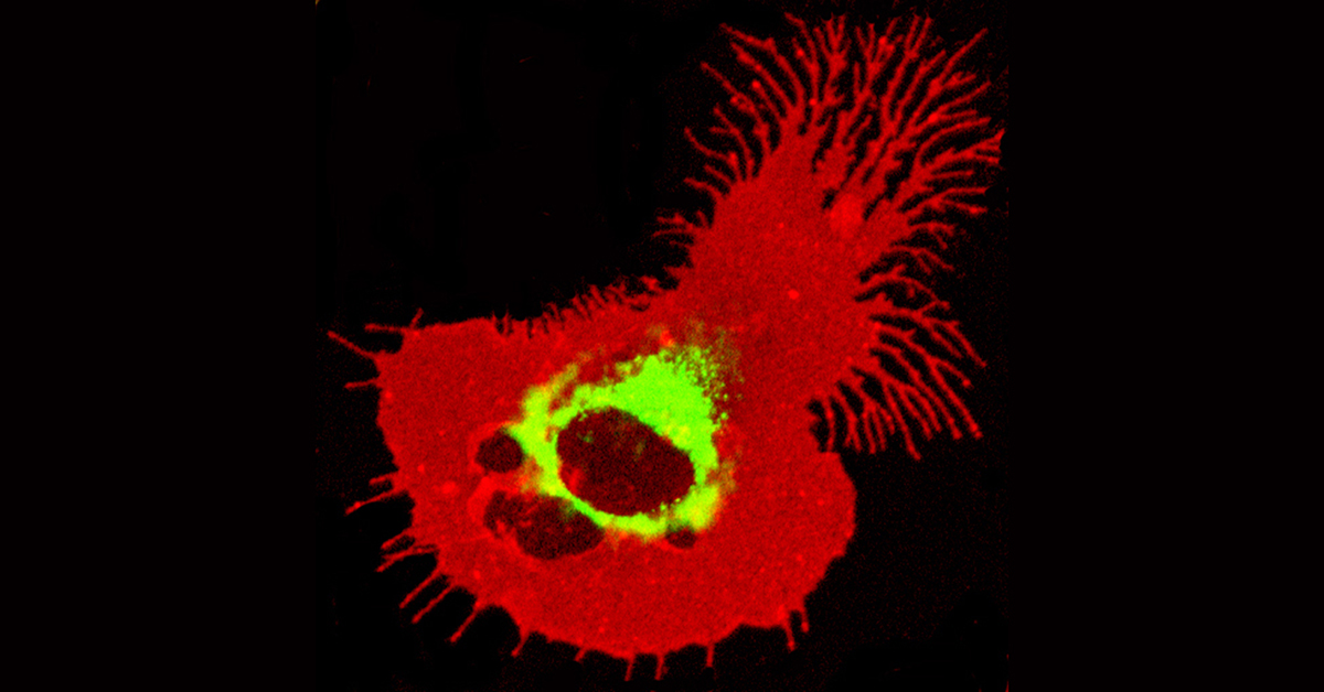 Dendritic cells. Image courtesy of WEHI.