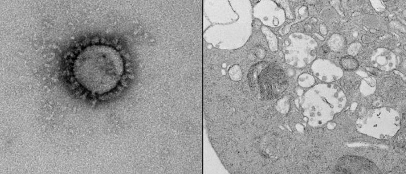 Electron micrographs showing spherical and pleomorphic viral particles of mean size 100 nm displaying the characteristic crown-like fringe of spike proteins and infected VERO/hSLAM sections with membrane-bound vesicles containing virus. Credit: Peter Doherty Institute for Infection and Immunity