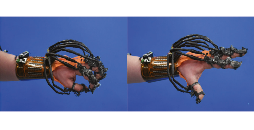 Figure 7. Using the glove during flexion and extension. CREDIT: Ranzani, et al. (2024) 