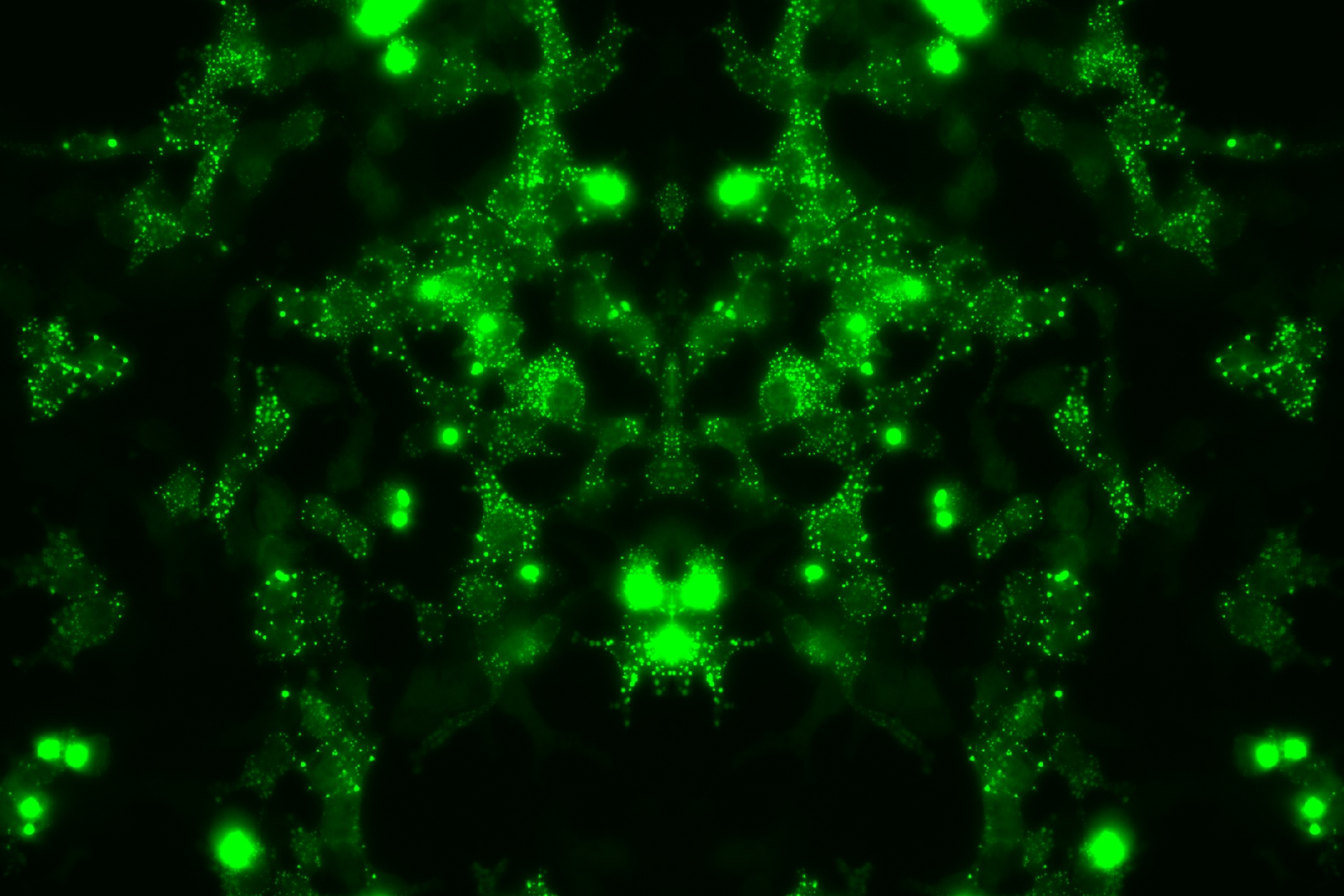 Cells expressing a mutant protein, TDP-43, involved in MND pathology. Credit: Dr Rebecca San Gil at the Queensland Brain Institute