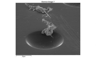 Acanthamoeba on contact lens