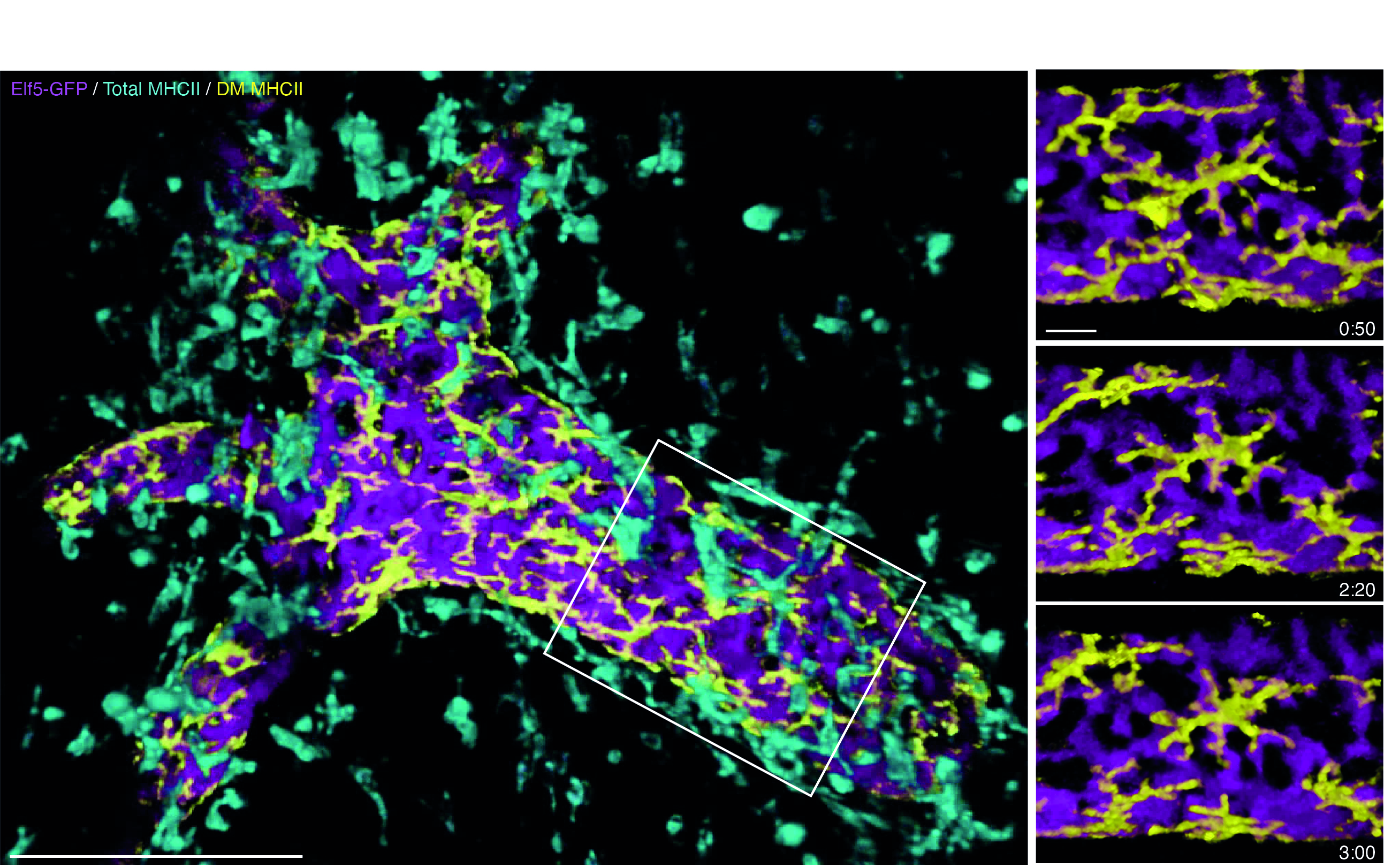 Breast duct immune cells. Image courtesy of WEHI.