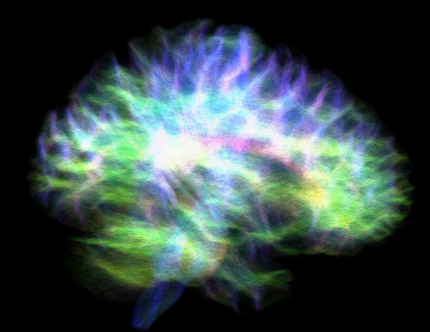 High-resolution image of the ‘wiring diagram’ of a human brain focusing on the hippocampus connections [Marshall Dalton]