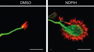 Comparison of the growth cones of the control and treated neurons