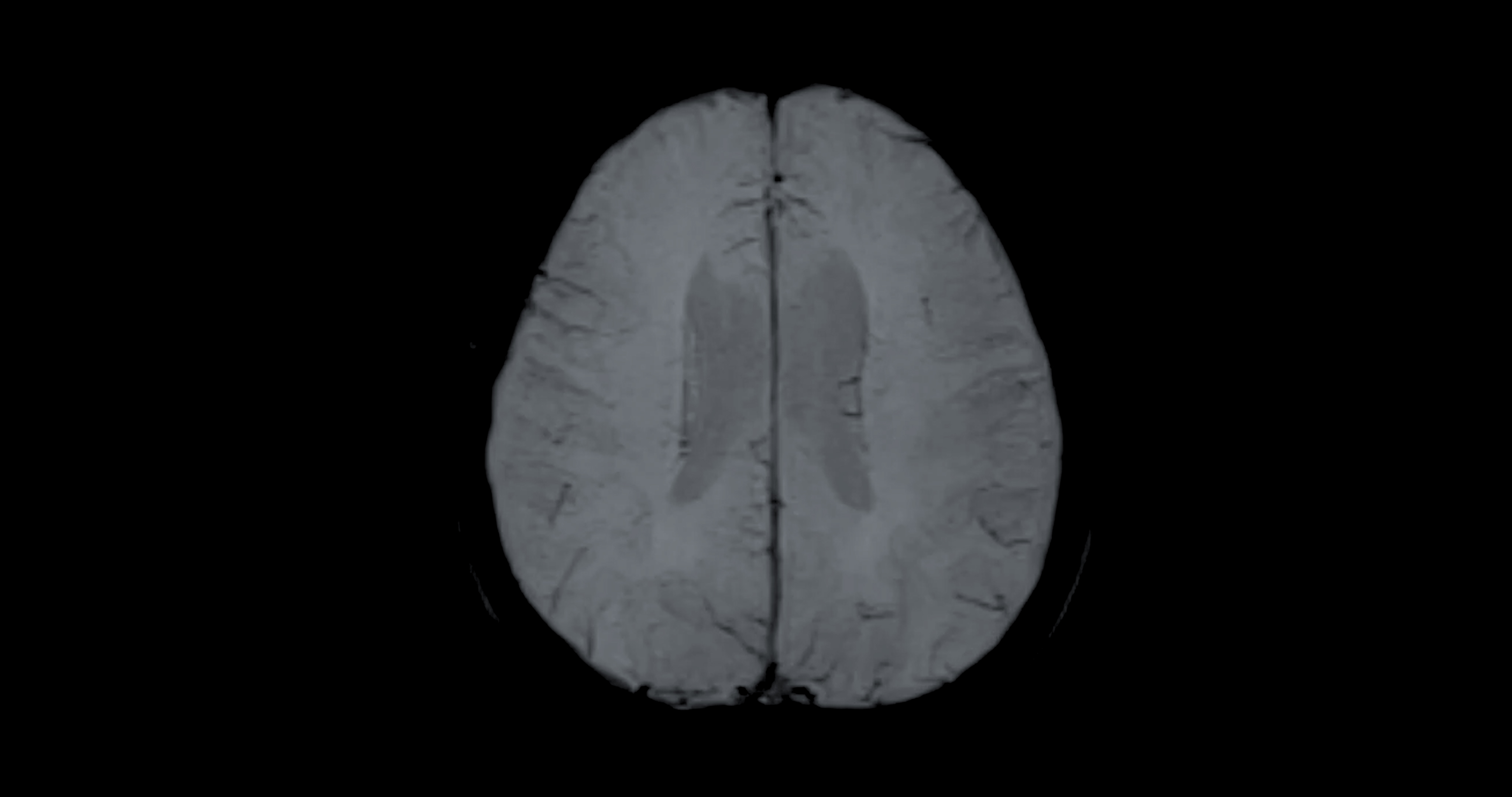 The latest study used a functional MRI scanner where 270 twins completed a number of tasks. Photo: Getty images