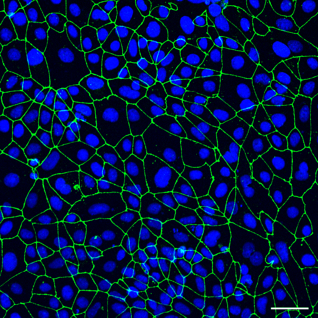 Supplied QIMR Berghofer