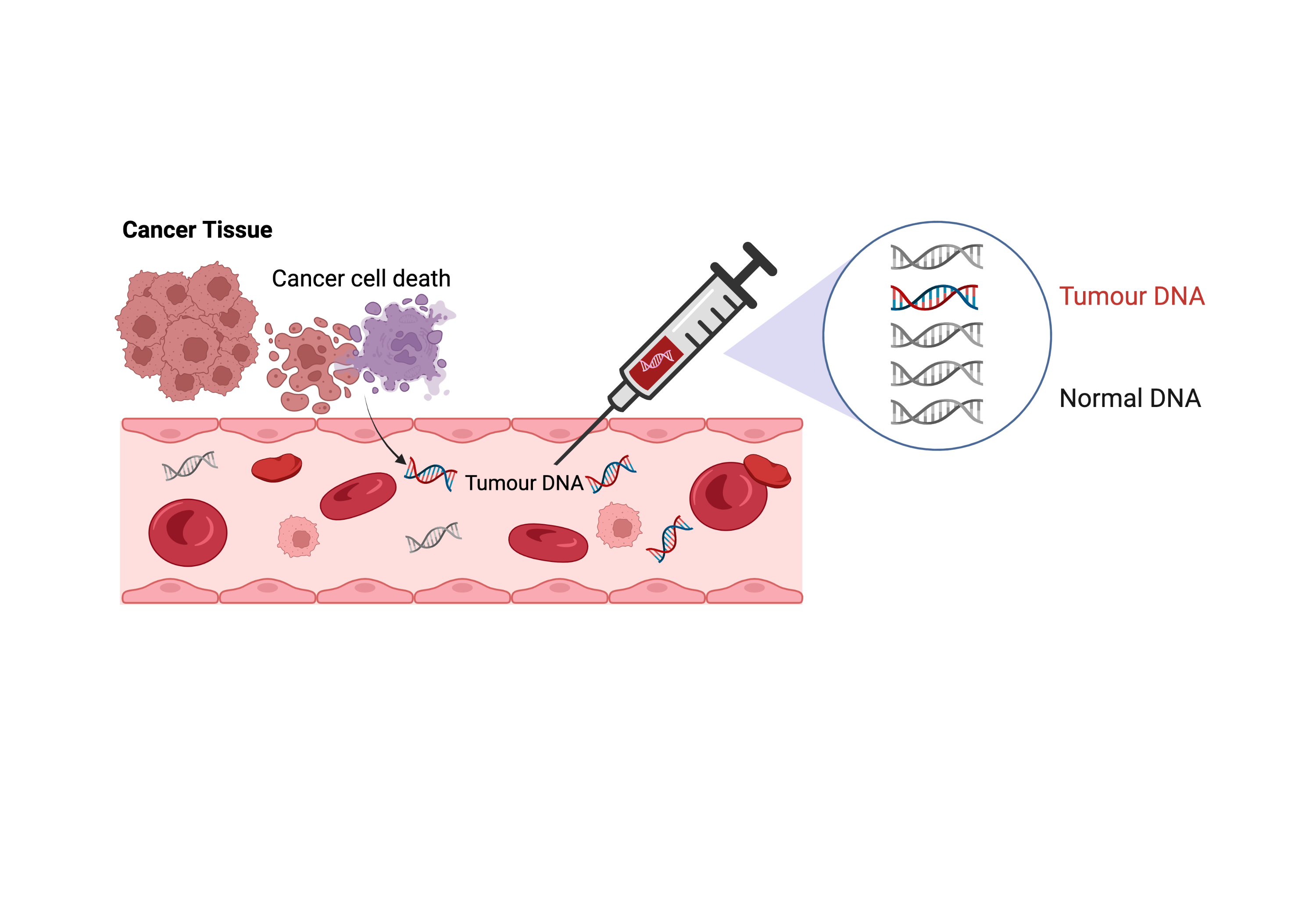 After successful surgery to remove a bowel cancer this new blood test can detect small fragments of cancer DNA in the blood in a small percentage of patients with stage 2 colon cancer, which indicate the presence of otherwise undetectable cancer cells (micrometastases) in the body, which will grow into metastatic cancers if not treated with chemotherapy.