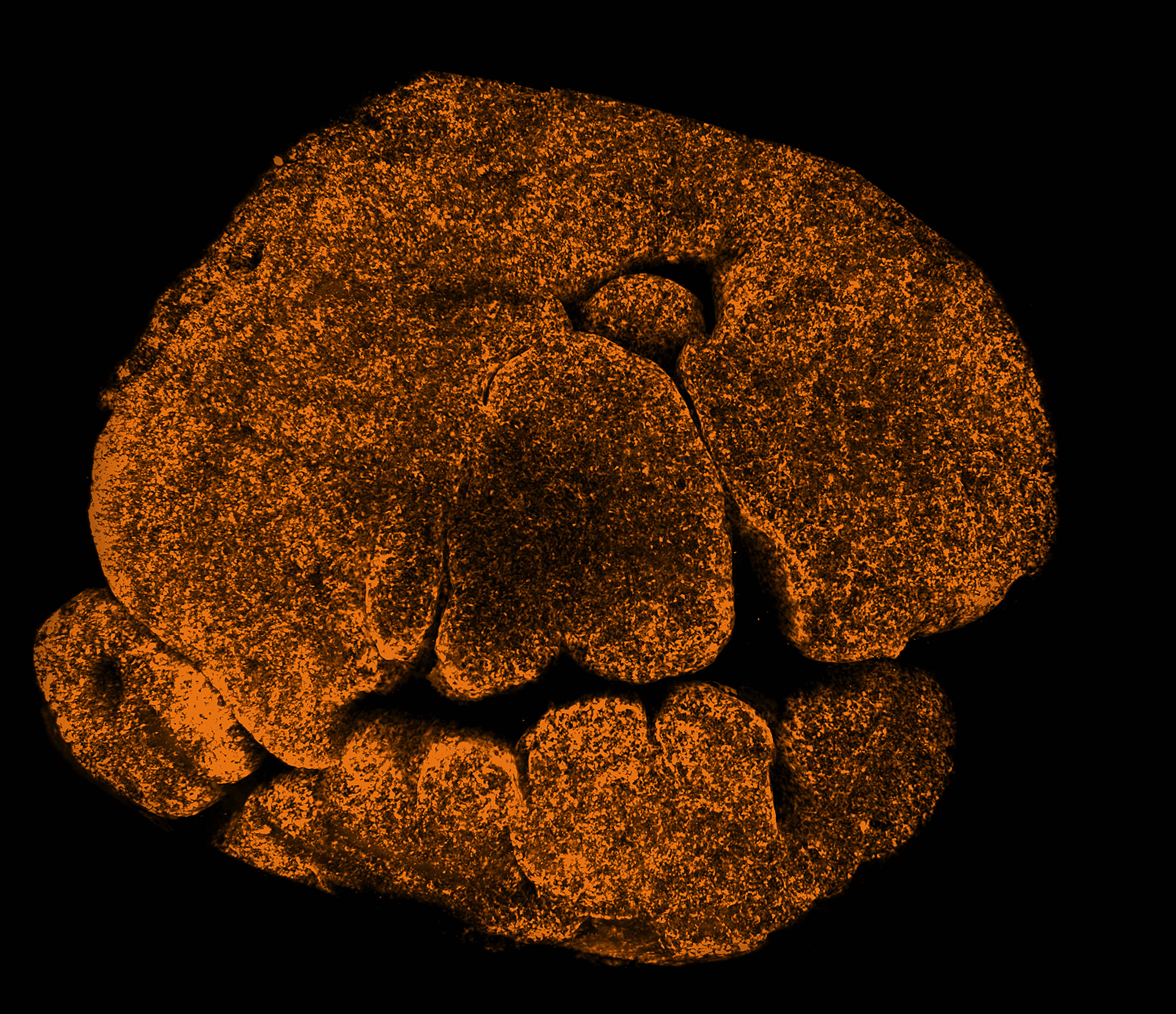 Reminiscent of a Halloween pumpkin, this collection of dots shows cells forming part of the thymus. Credit: WEHI