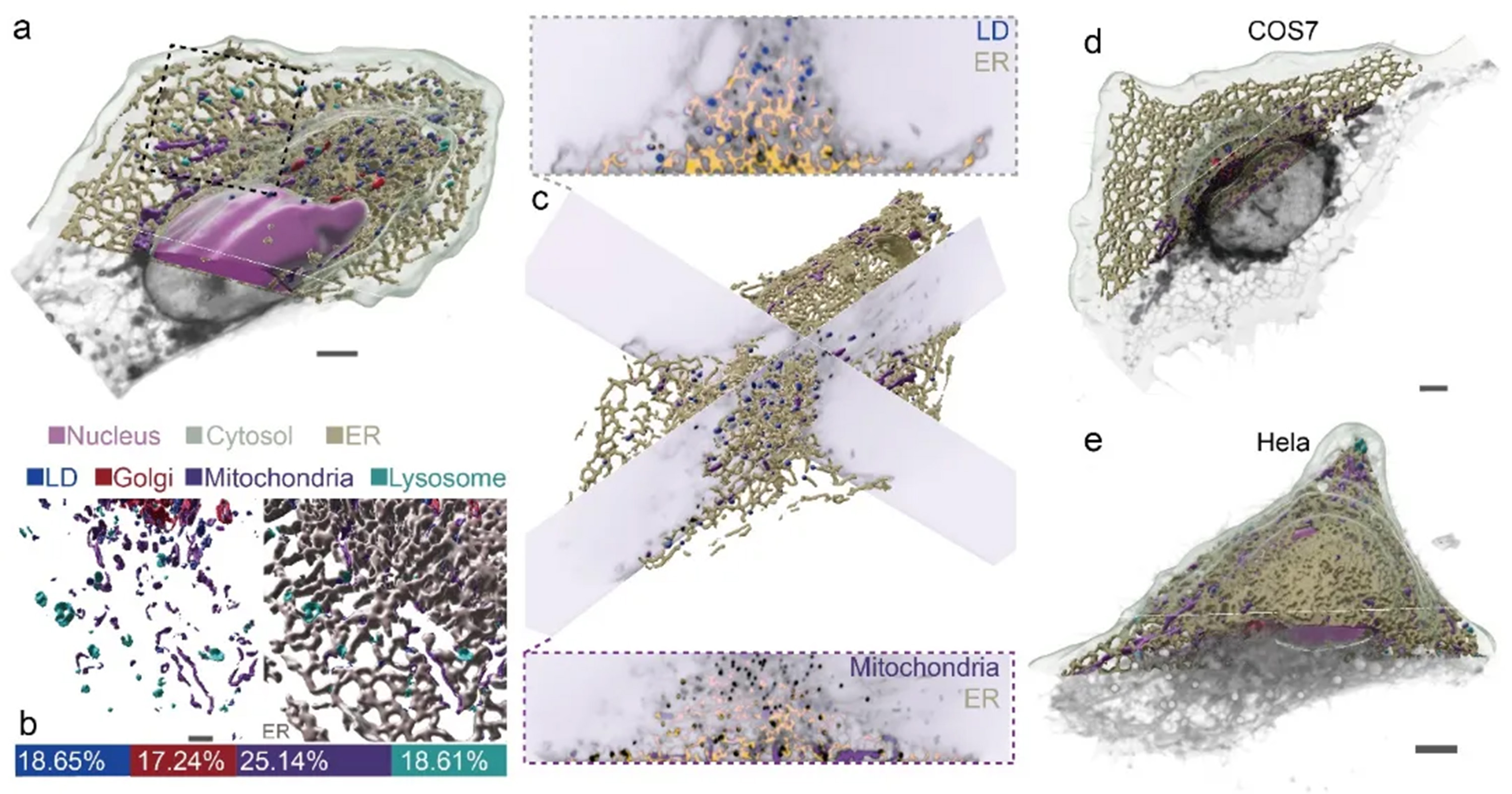 Multi-organelle imaging technology based on lipid dyes and deep learning to achieve multi-organelle segmentation of different biological samples.