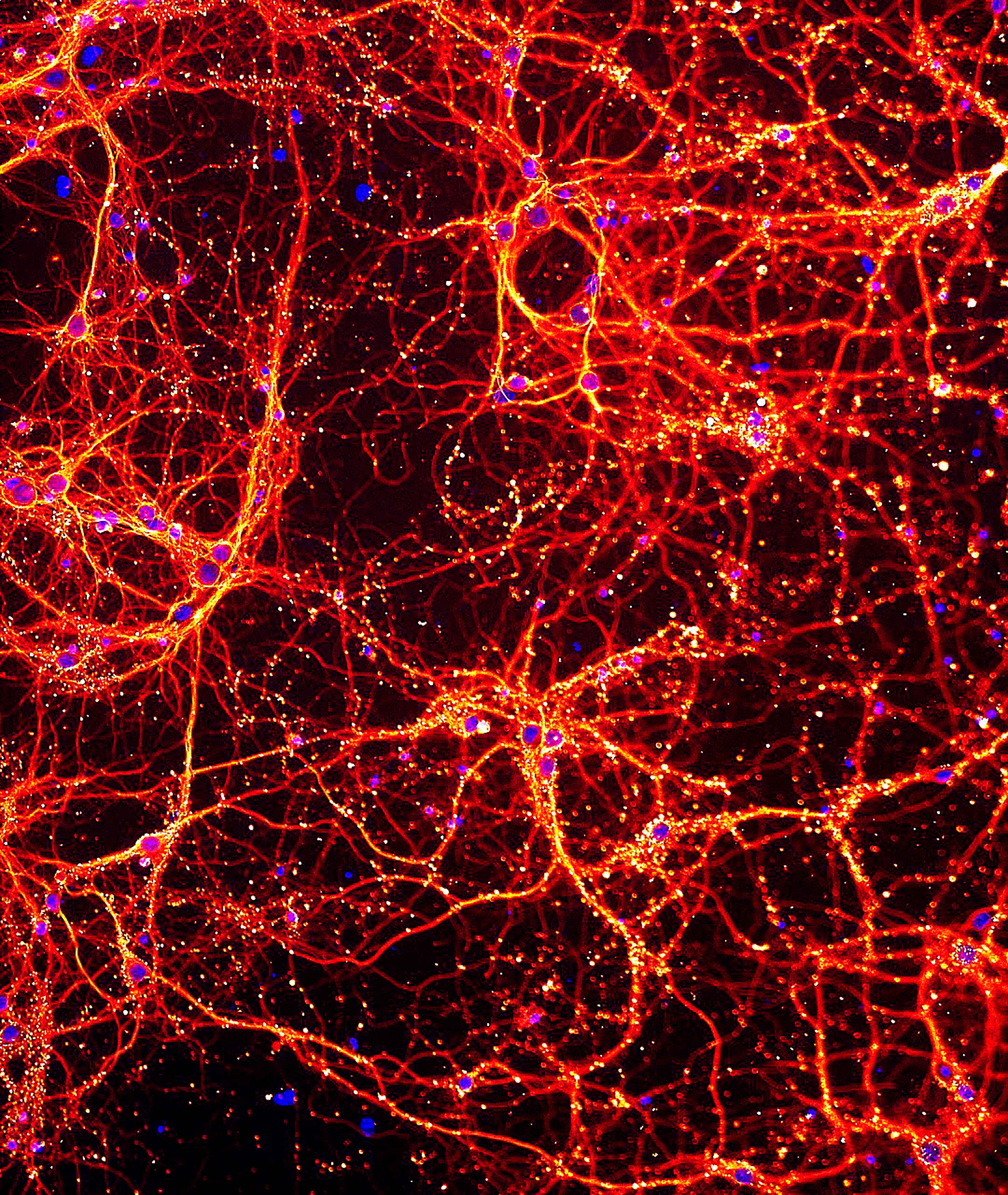 This image shows neurons and their connections to each other in red and yellow, and the cell’s DNA in blue. WEHI researchers have, for the first time, uncovered the Trabid protein’s critical role in the development of healthy neurons, which are essential for the proper functioning of our nervous system and overall quality of life. Credit: Simone Seizova and Shiraz Tyebji, WEHI 