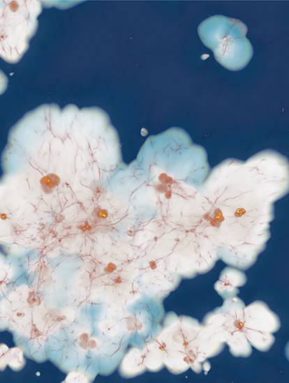 Image: The process of reionization in numerical simulations. Credit: J. Rosdahl, H. Atek and the SPHINX project team