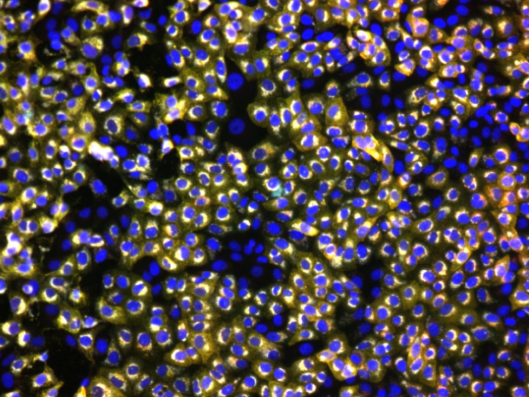 Representative microscopy image of SARS-CoV-2 infected cells stained with antibodies in convalescent plasma. Image credit: Dr Michael Joyce, University of Alberta. 