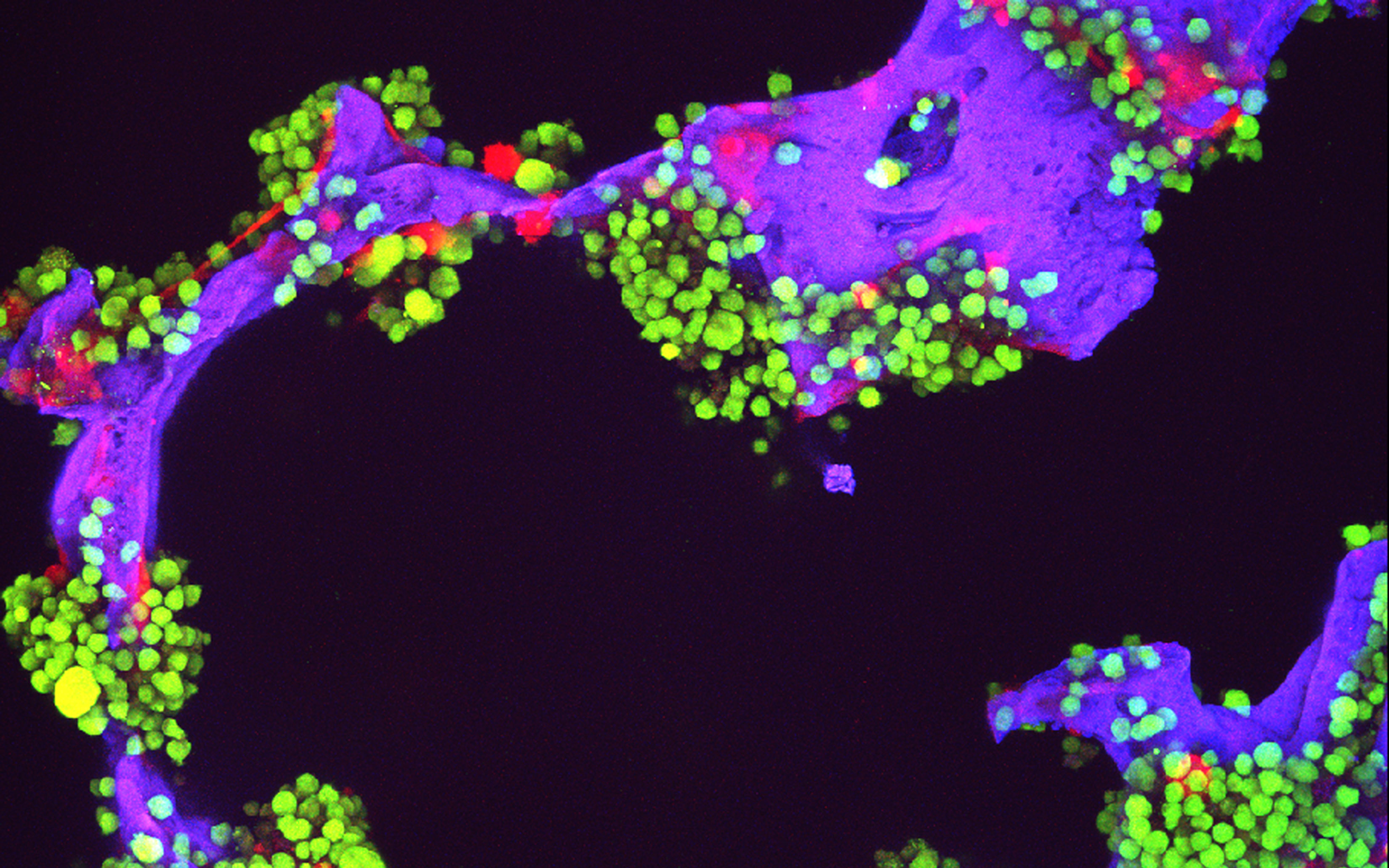 Source: National Cancer Institute \ Dana-Farber Harvard Cancer Center