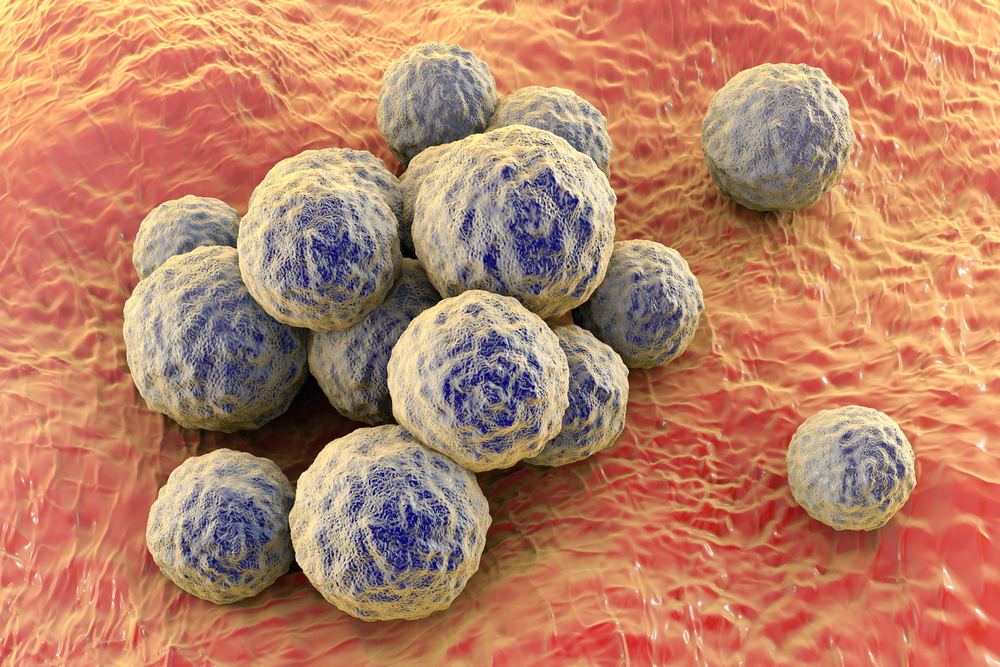 Staphylococcus aureus – MRSA, multidrug resistant bacteria – on surface of skin or mucous membrane, 3D illustration. Shutterstock
