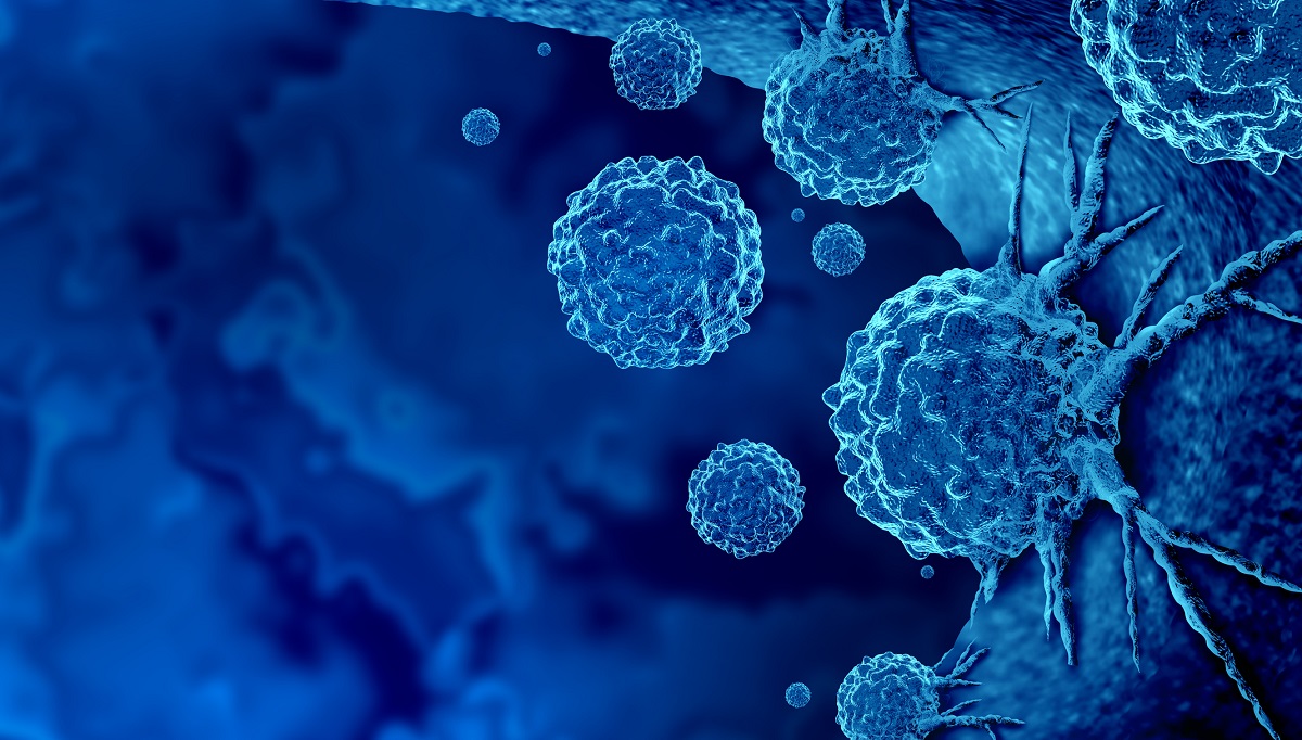 Stock photo: Getty Images