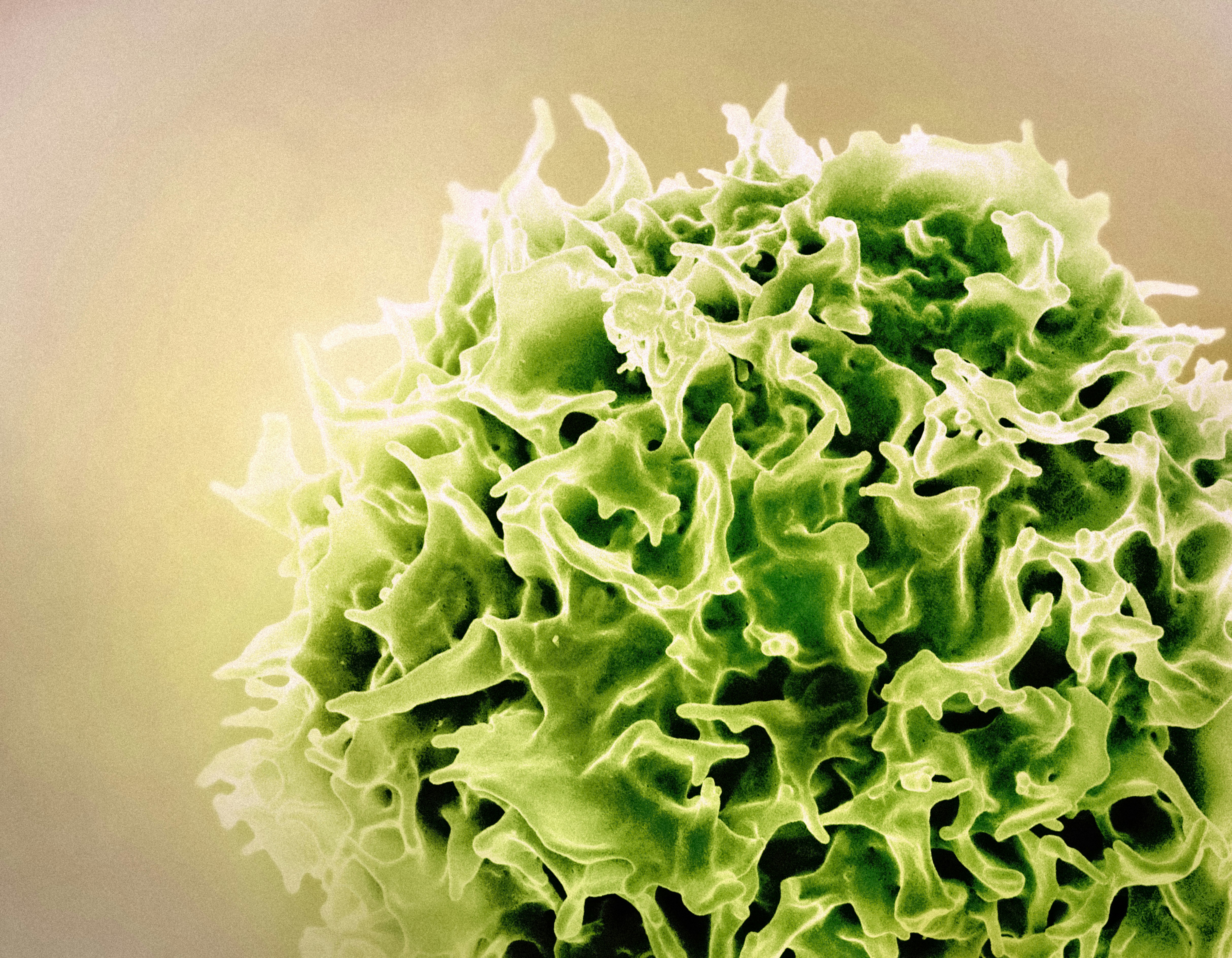 Colourised scanning electron micrograph of a T-cell. Credit: NIAID
