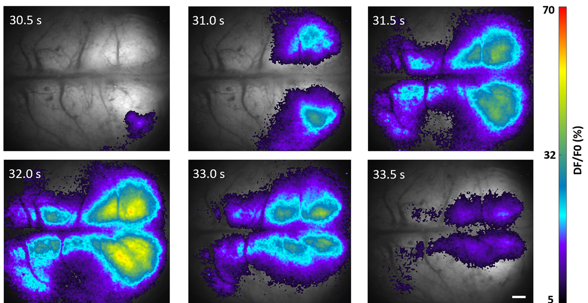 Credit: Jose et al; DOI 10.1117/1.NPh.11.1.014306; CC BY 4.0 