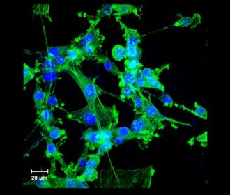Microscope image of neural cells after freezing