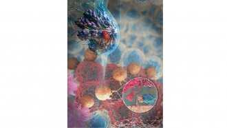 Uncovering how patients with triple -ve breast cancer respond to immunotherapy