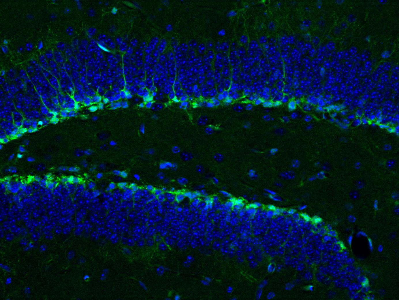 Neural stem cells in a mouse hippocampus shown in green (cell bodies shown in blue) give rise to new mature neurons. 