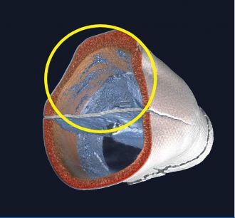 Micro-CT scan of the tooth 