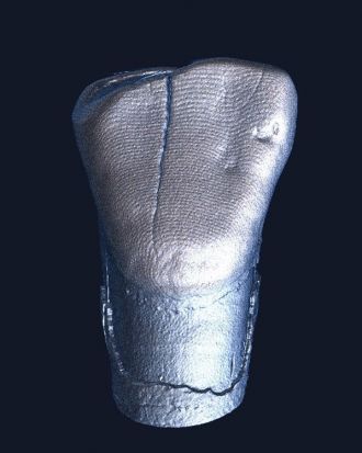 Micro-CT scan of a whole tooth 