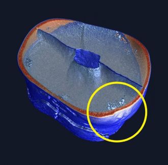 Micro-CT scan of the tooth's external defect 