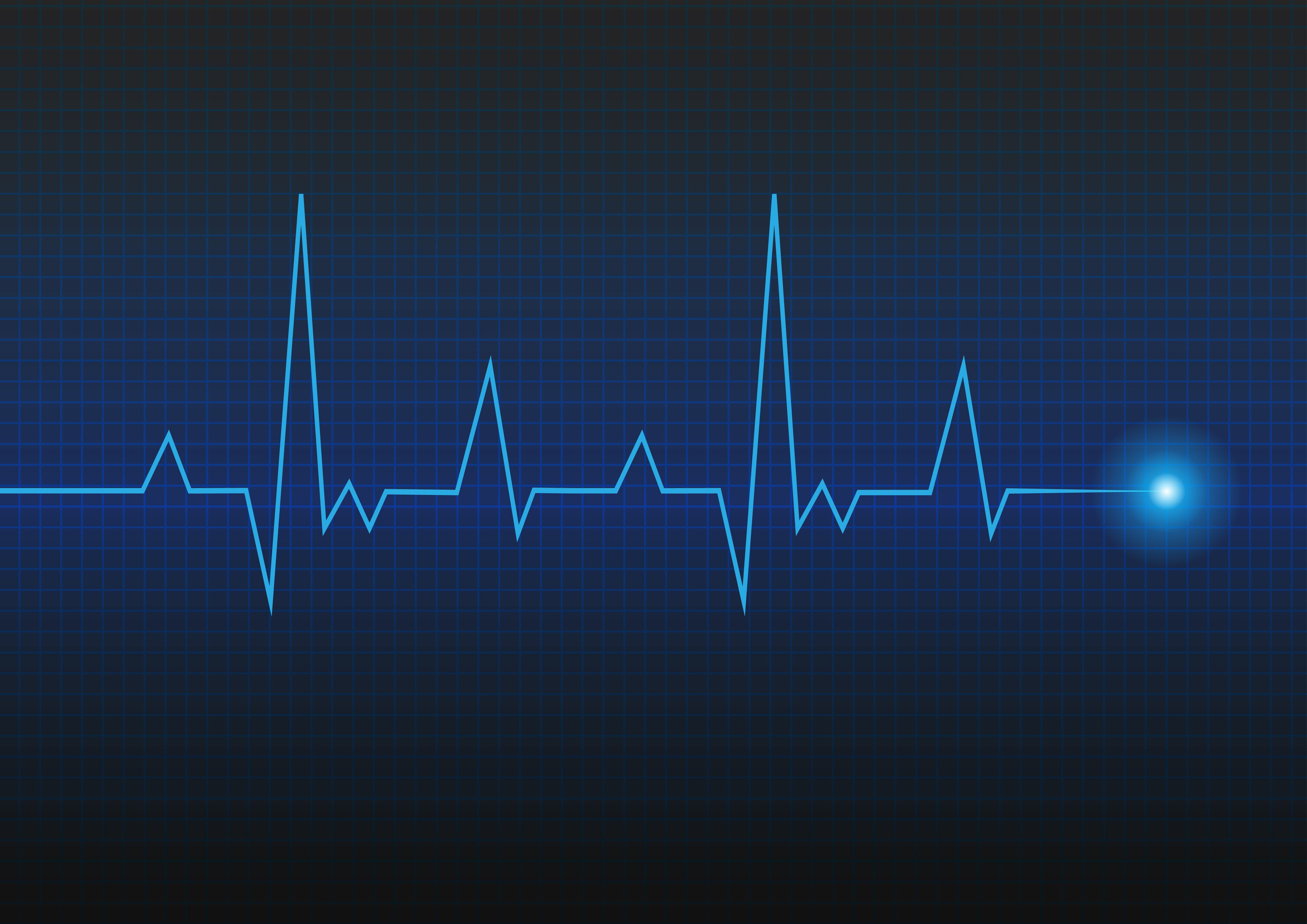 ECG heart rate monitor readout. Credit: Adobe Stock