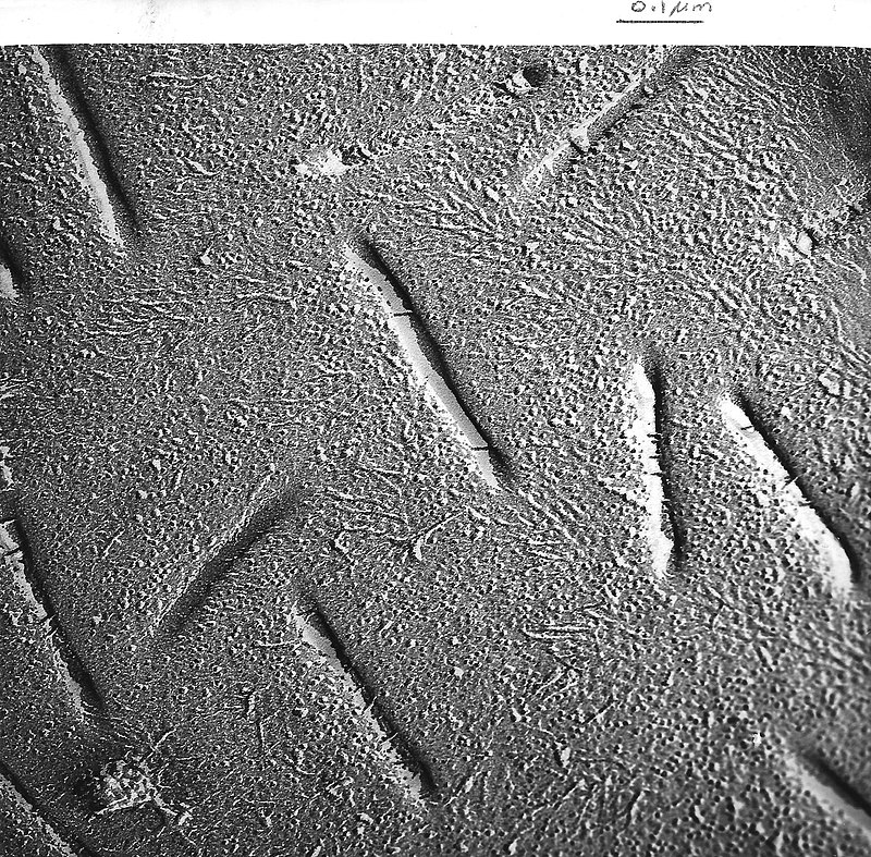 CC-0. https://commons.wikimedia.org/wiki/File:Bakers_yeast_membrane_3.jpg