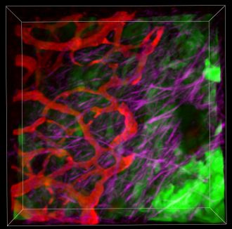 Microscopic view inside mouse model of pancreatic cancer tumour