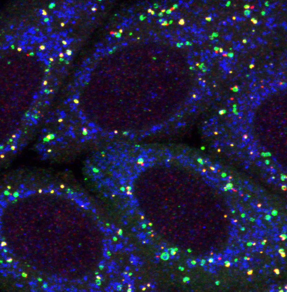 Mitochondria (blue) being targeted by mitophagy (green and red). Credit: WEHI