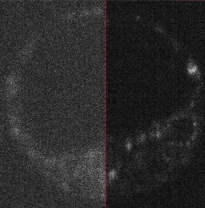 Image of a live mouse embryo with and without optimised capture. PHOTO: University of Adelaide