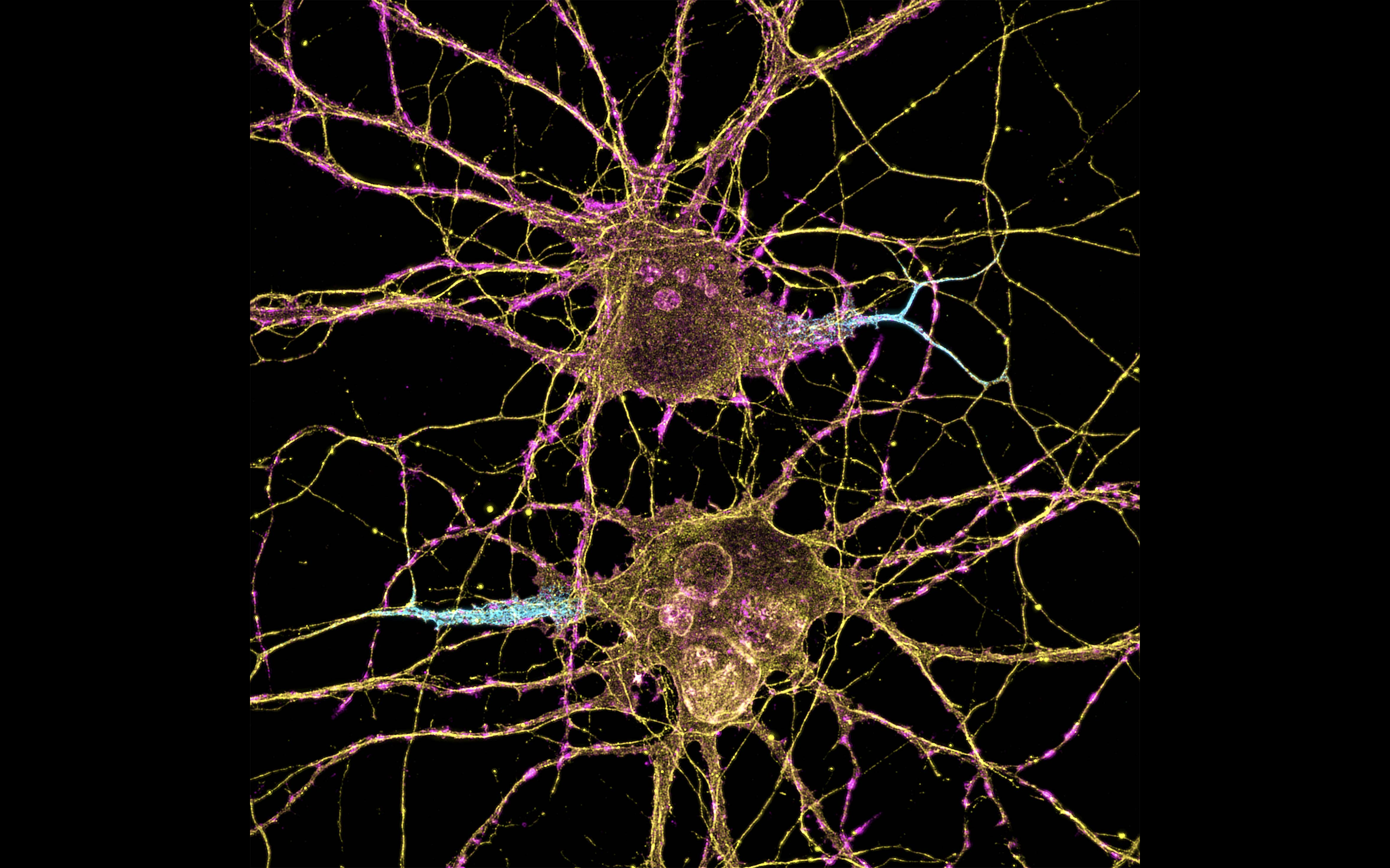 Leterrier, NeuroCyto Lab, INP, Marseille, France https://creativecommons.org/licenses/by-nc/2.0/