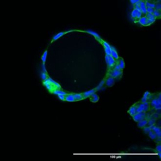 AIBN Microfluidics 2