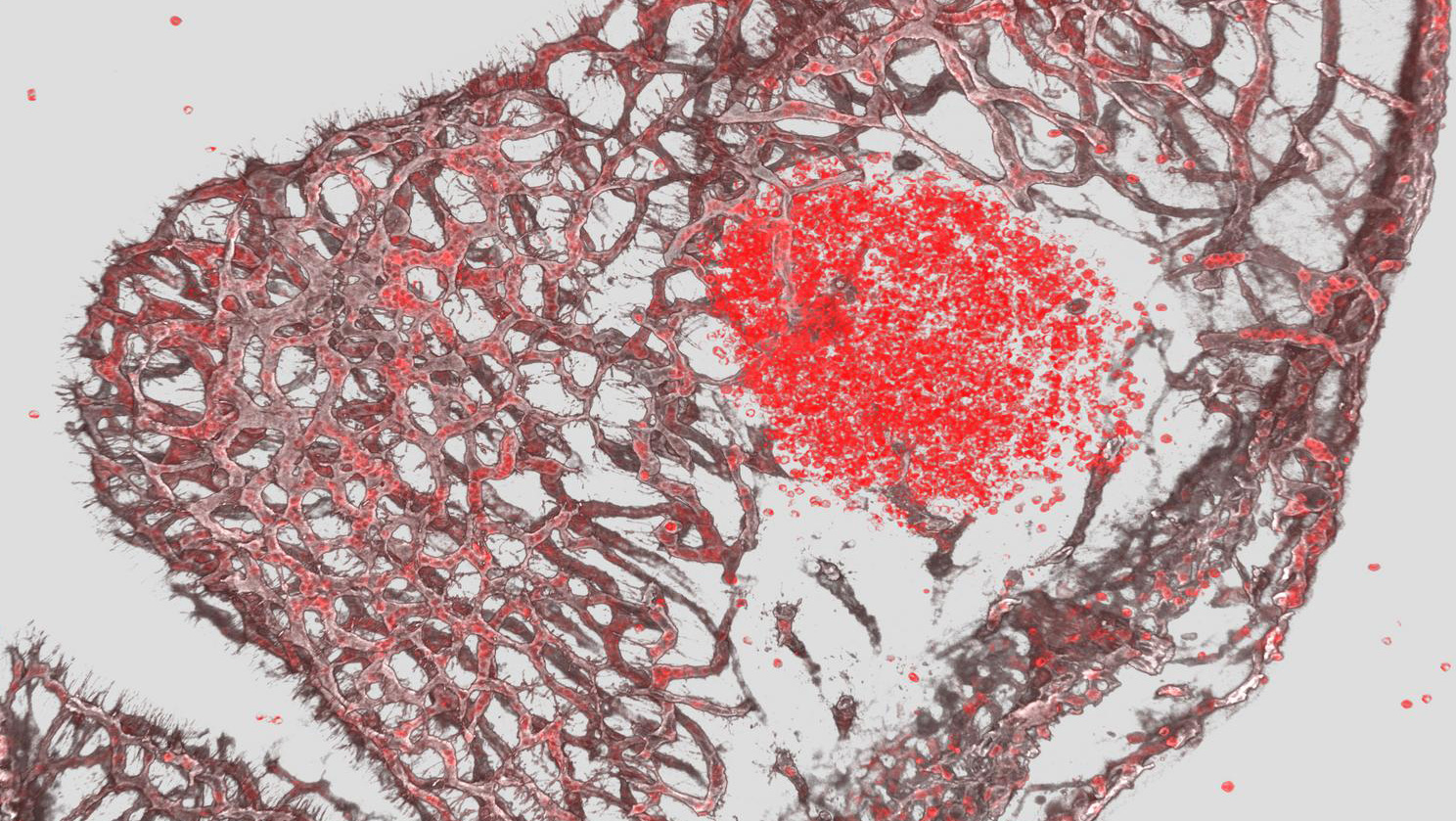 Brain bleed (bright red) and all the blood vessels in the developing brain of a mouse that has low platelets. Image courtesy of WEHI.