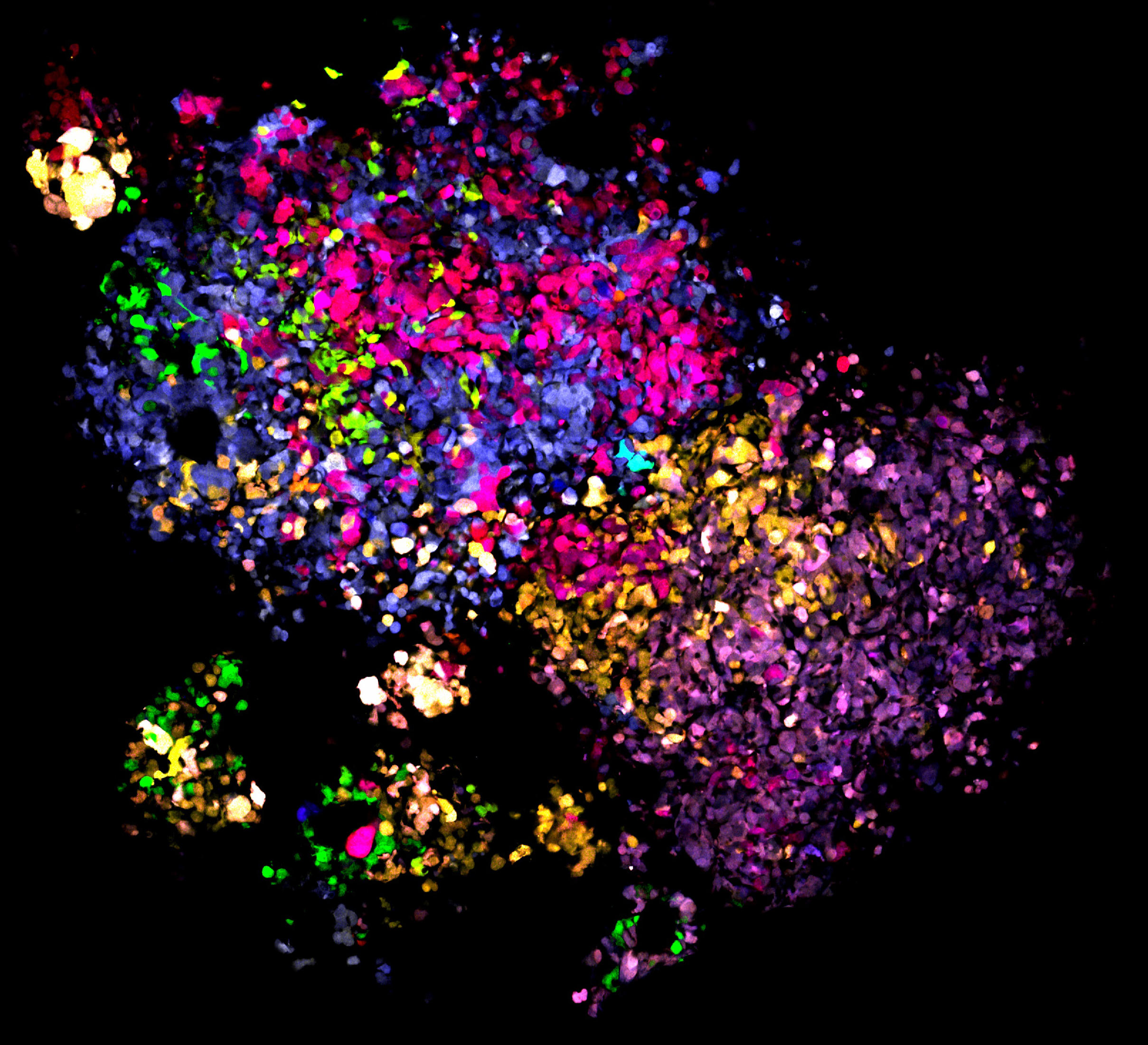 Breast cancer cells labelled with LeGO optical tags