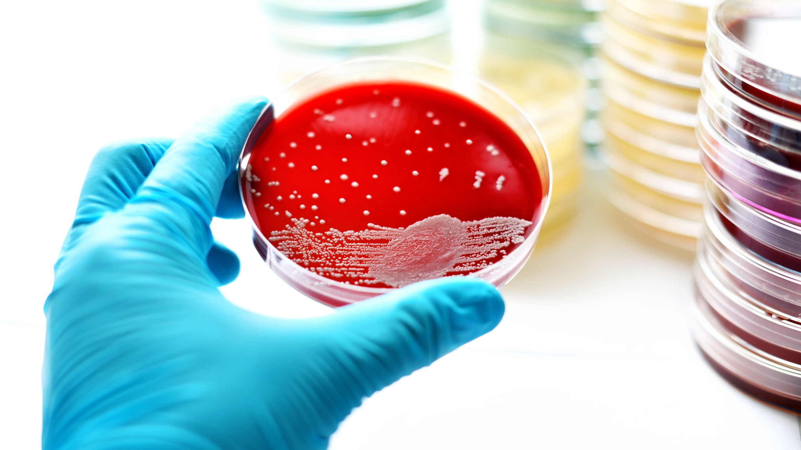 Colonies of bacteria in blood agar (Stock image)