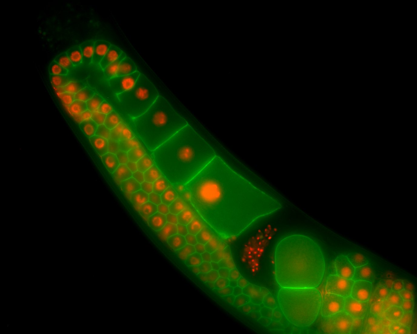 Worm expressing fluorescent proteins that mark chromosomes (red) and plasma membrane (green).  (C) Roger Pocock