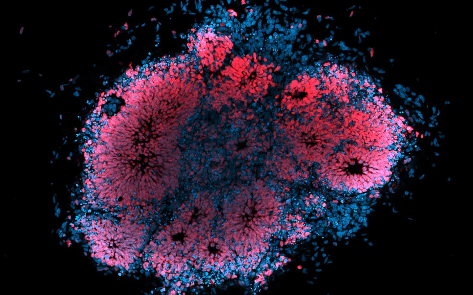 Microscopic image of human brain organoid infected with Zika virus. Image: Dr Julio Aguado (AIBN, UQ)
