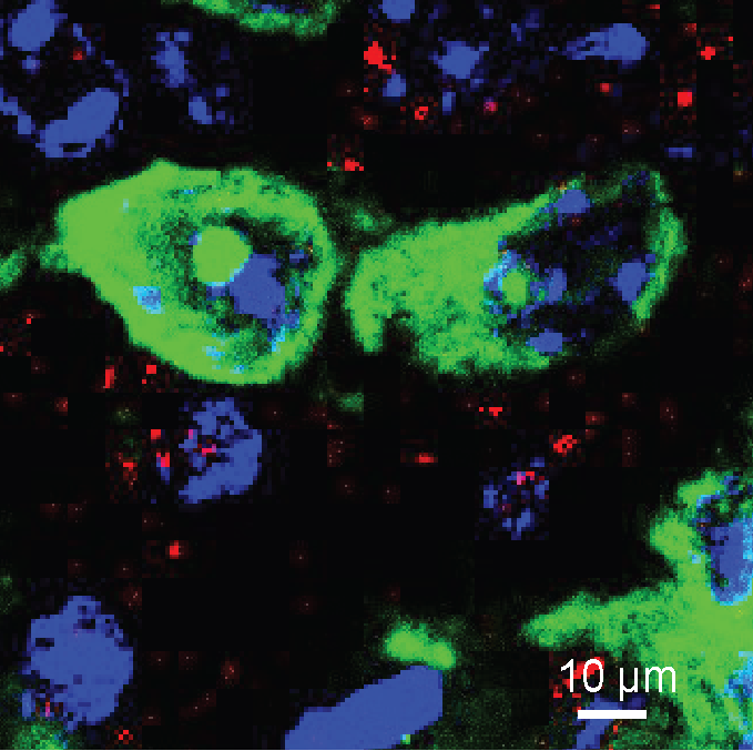 Researchers have pinpointed a subset of neurons in the brain (green) that drive appetite under obesity.   Credit: Dr Yue Qi