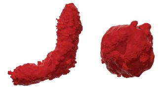 Normal vs disrupted mitochondria