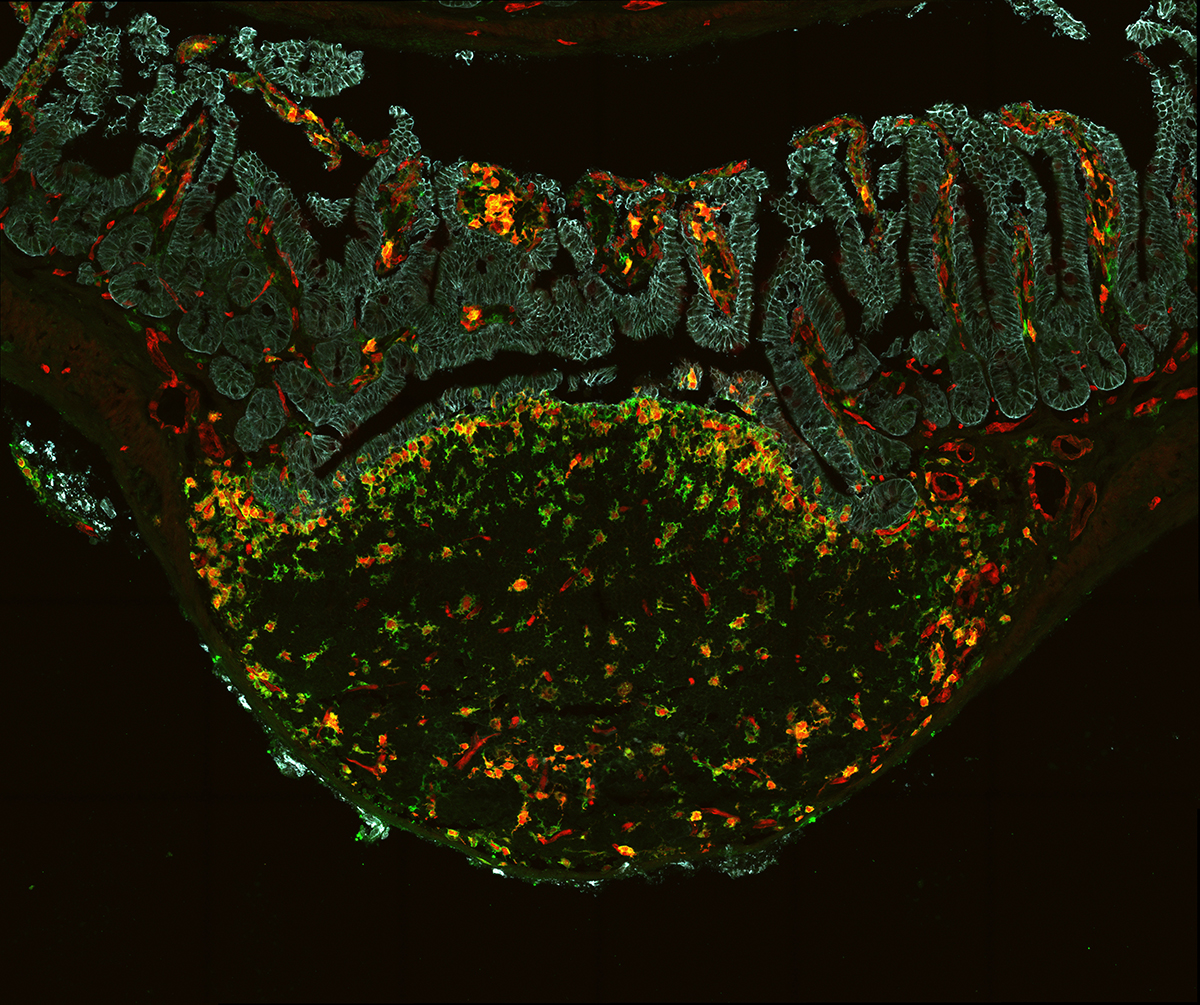 Dendritic cells (co-stained Red/green) in a lymphoid follicle (peyer's patch) draining the intestine (blue). Image credit: Wang Cao and Shengbo Zhang