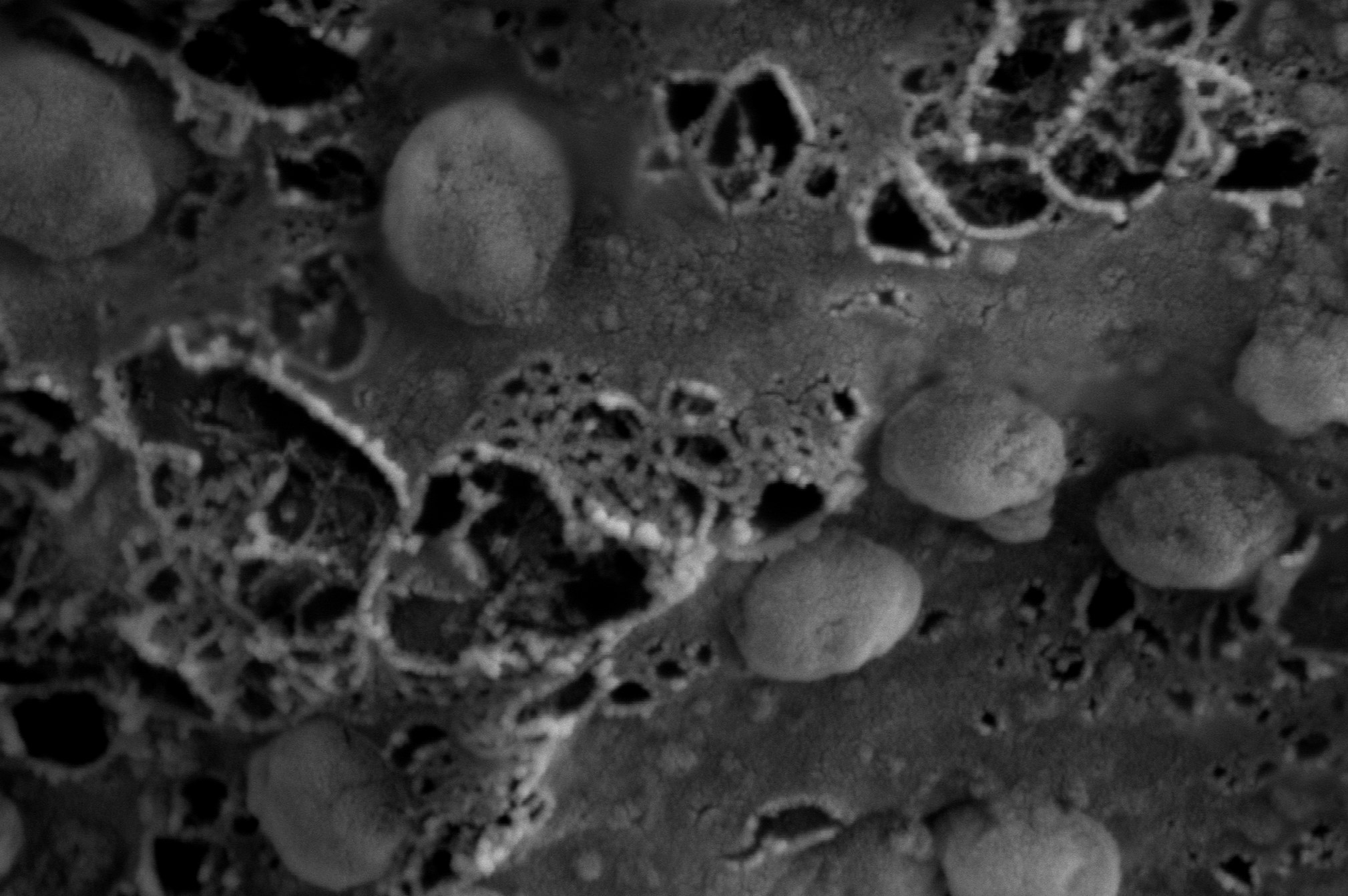 A scanning electron microscopy image are presented showing the morphology and size of the anti-viral exosomes