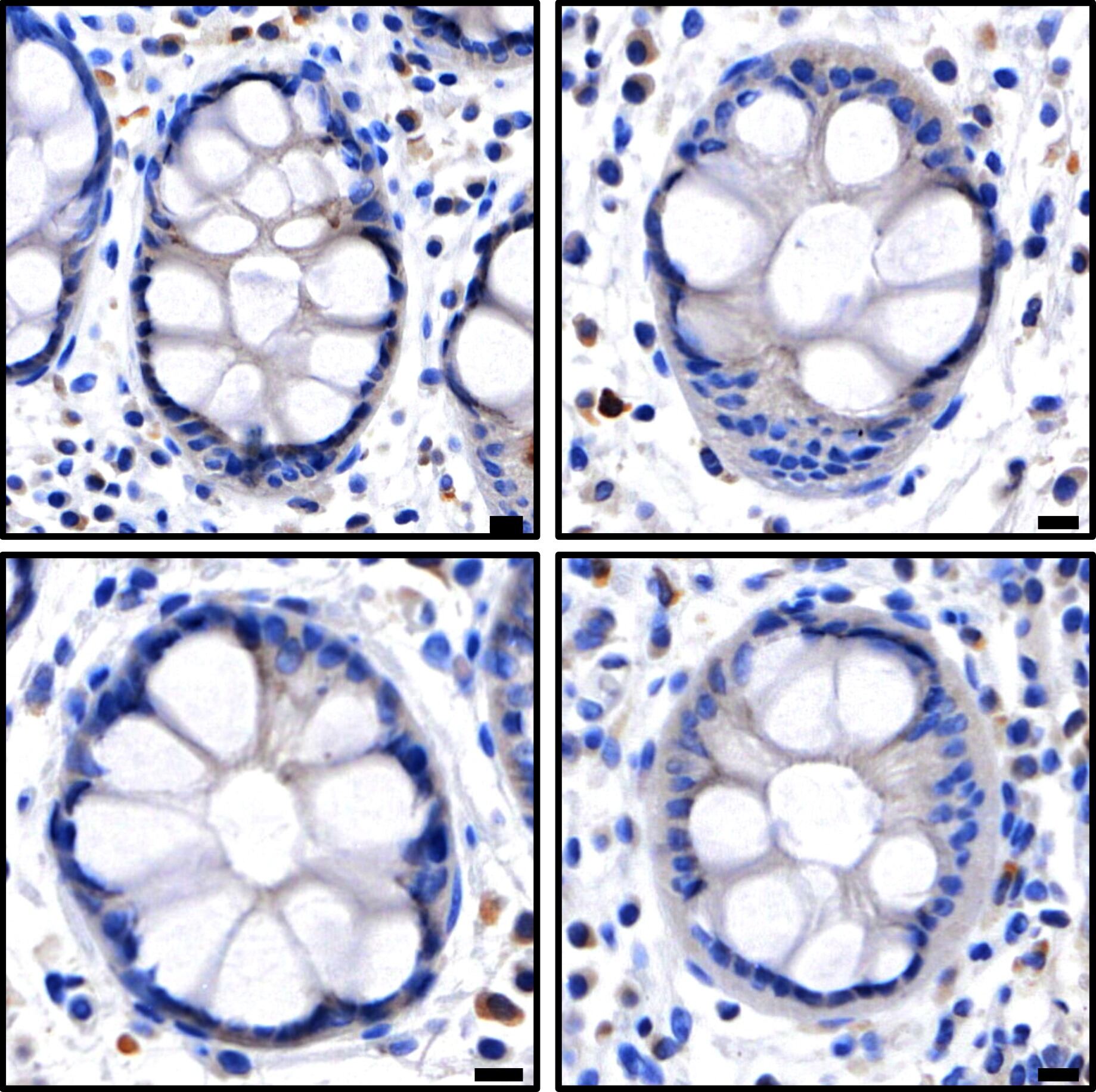 Atlas of necroptotic pathway expression in human intestinal crypts.  Credit: WEHI. 