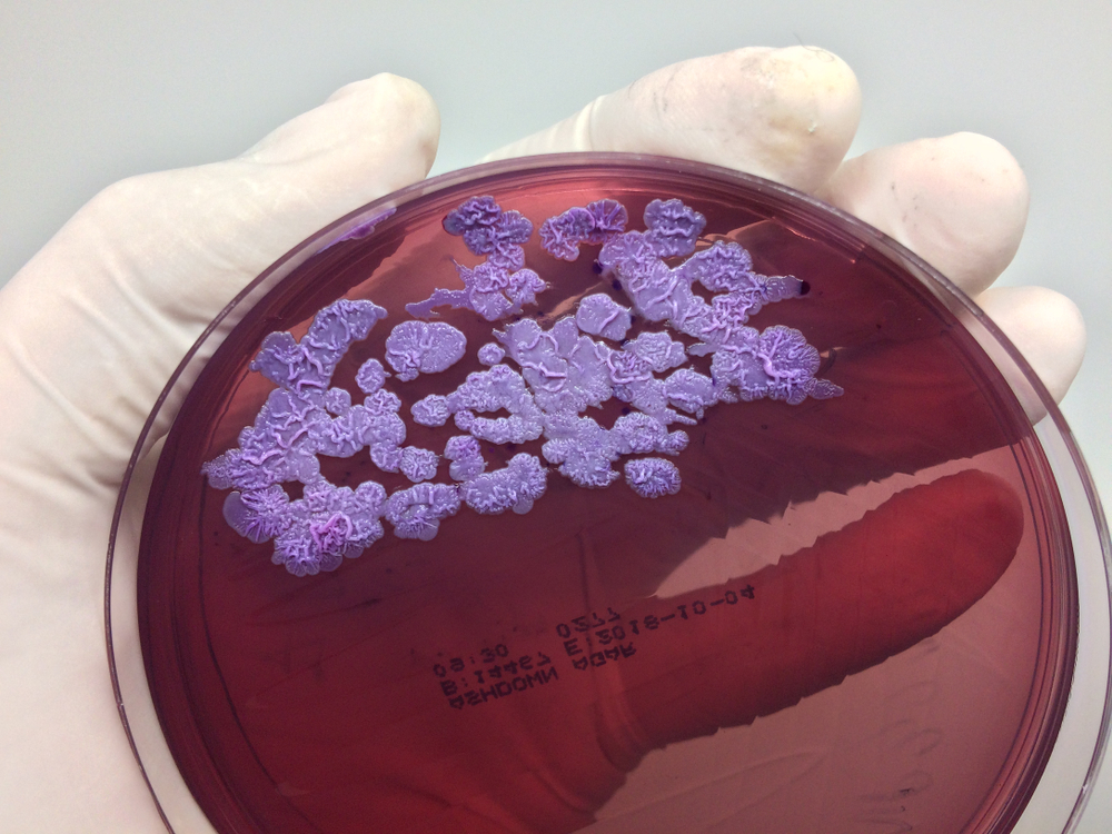 Burkholderia pseudomallei