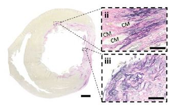 Cross section of heart muscle sample