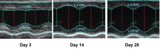 Echocardiography of the heart wall. 
